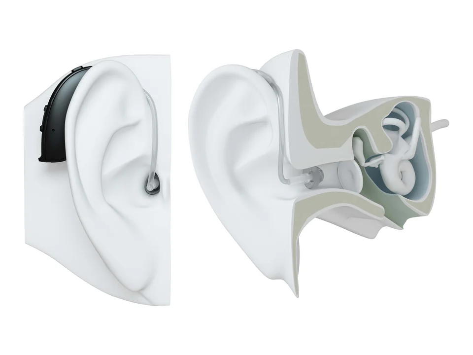 Behind the ear (BTE)