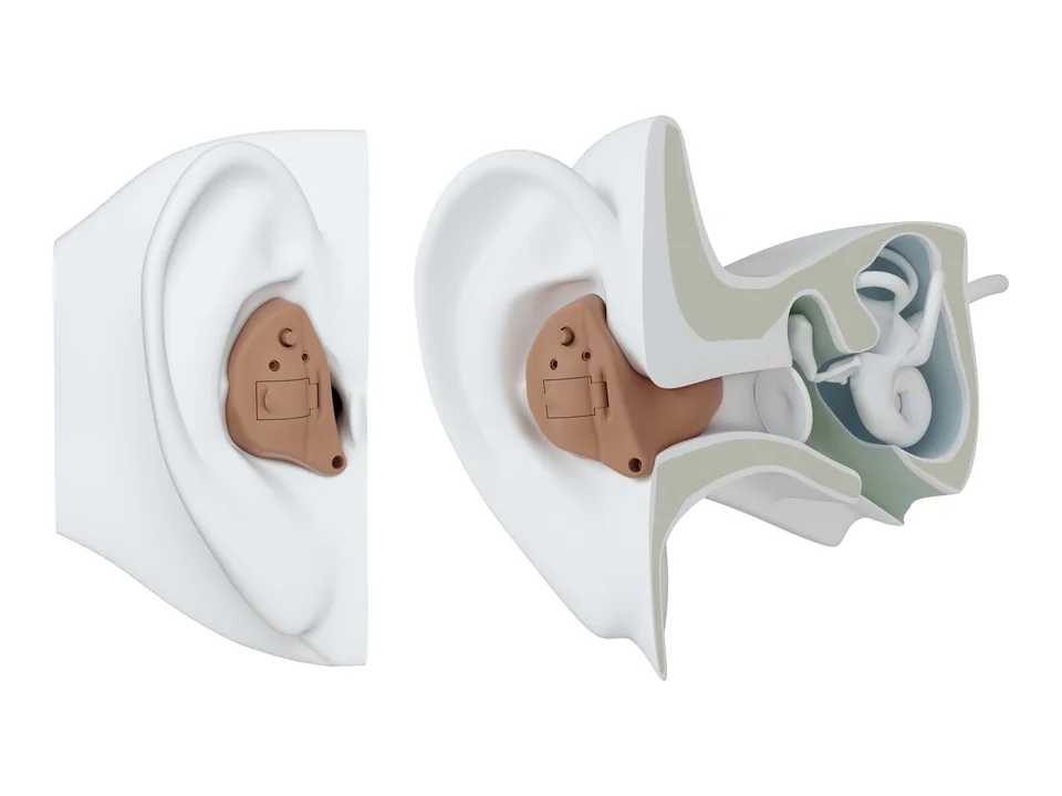 In the ear (ITE)